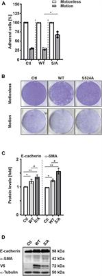 Protein kinase B/AKT phosphorylates hypoxia-inducible factor-3α1 in response to insulin, promoting cell growth and migration